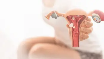 Como Tratar a Endometriose?